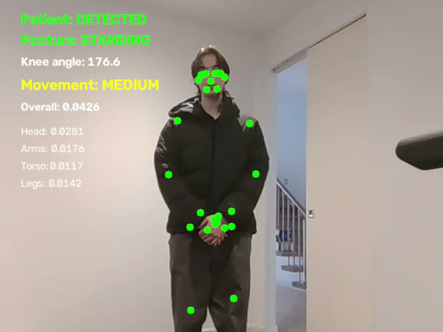 Webcam frame of a person standing in a hallway with green tracking dots on the face and body, and an overlay reading Patient detected, Posture standing, Movement low.