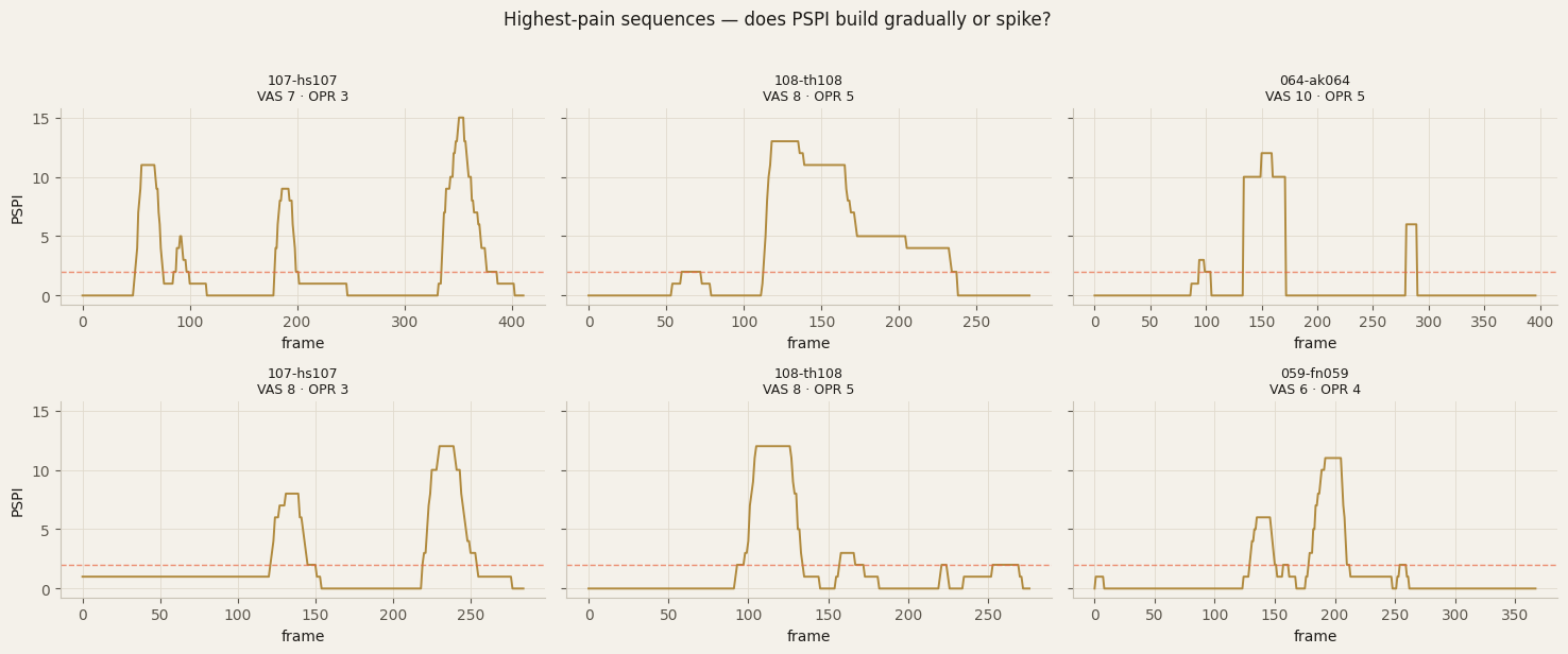 Six line charts of PSPI pain intensity over time for the highest-pain sequences, each rising, holding and decaying rather than spiking.