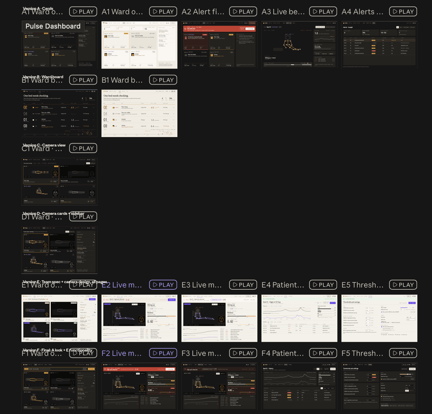 A design board of dark dashboard mockups in six rows, labelled Version A to Version F. The rows show ward overviews with four bed cards, a ward board list, camera views with stick-figure skeletons over a bed, a live view with a red high pain detected banner and an acknowledge button, a night's history chart for bed 01, and a thresholds and settings page. The bottom row, Version F, is labelled Final.